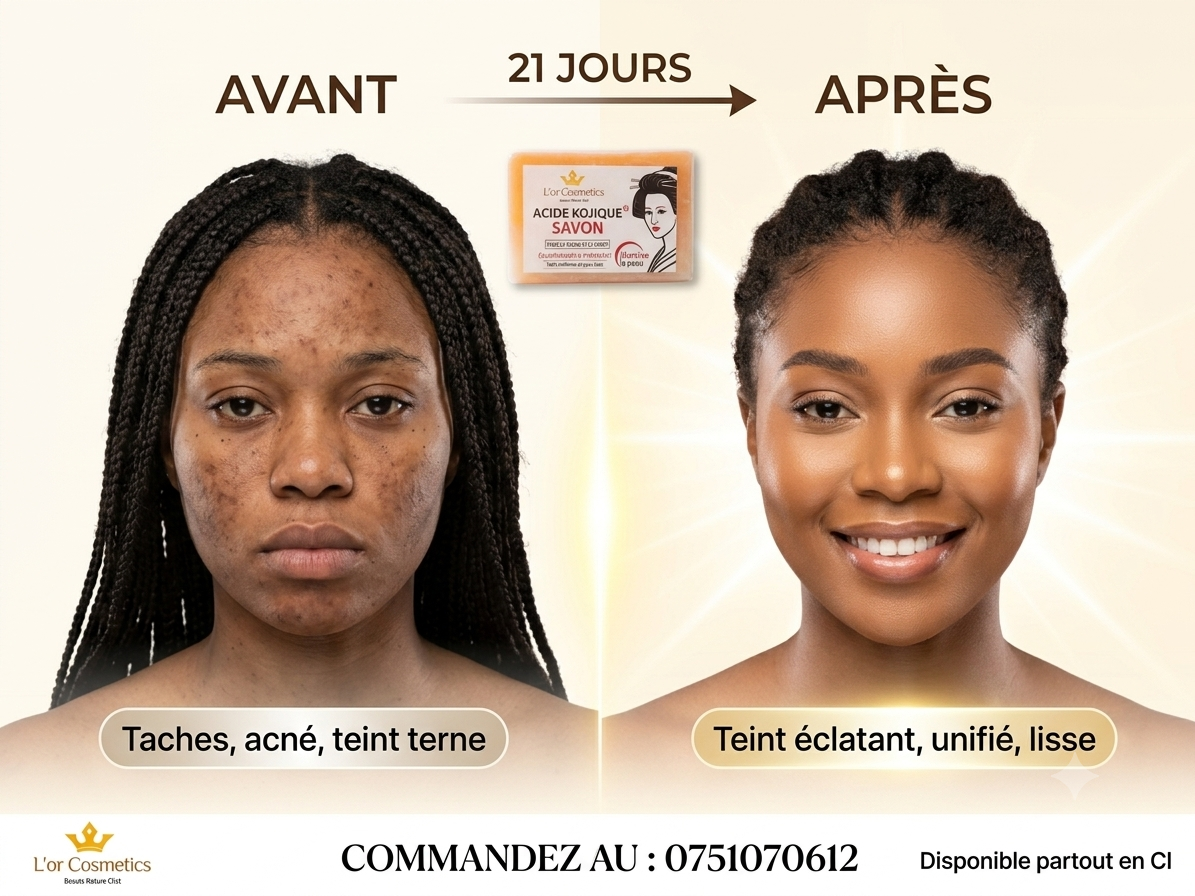 Savon à l'acide kojique, savon corporel artisanal nettoyant en profondeur, resserre les pores, illumine le teint et hydrate la peau. Savon essentiel nettoyant